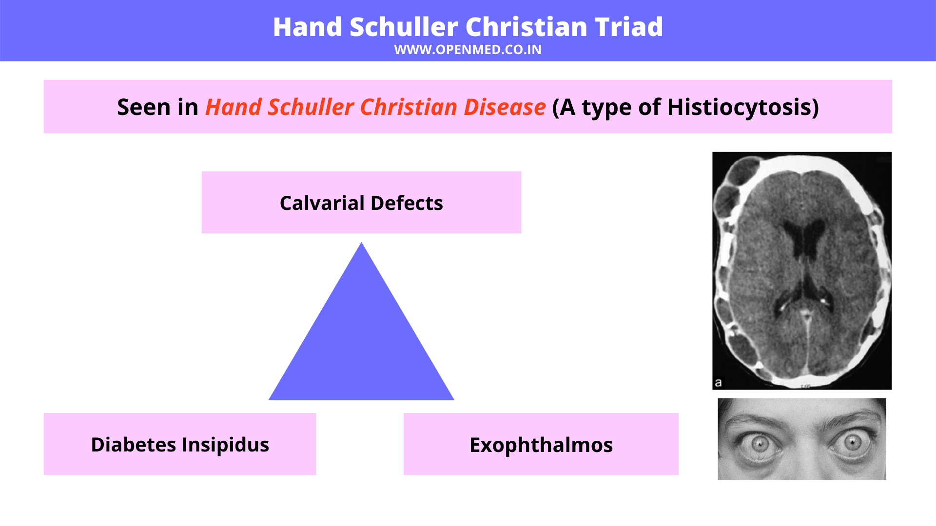 Hand Schuller Christian Triad